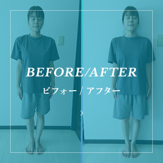 BEFORE/AFTER
